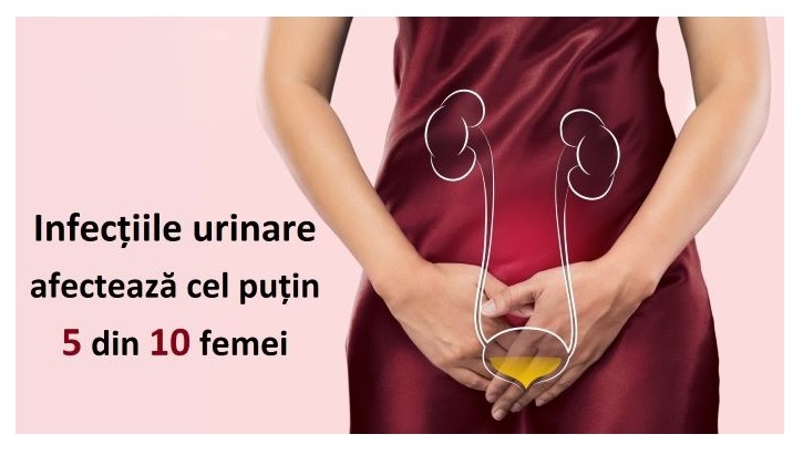 Infecțiile urinare afectează cel puțin 5 din 10 femei. Care este tratamentul