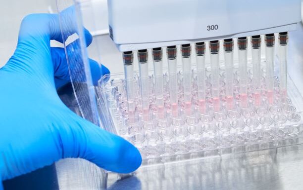 Primul test de sânge minim invaziv care ajută la excluderea bolii Alzheimer, disponibil în România